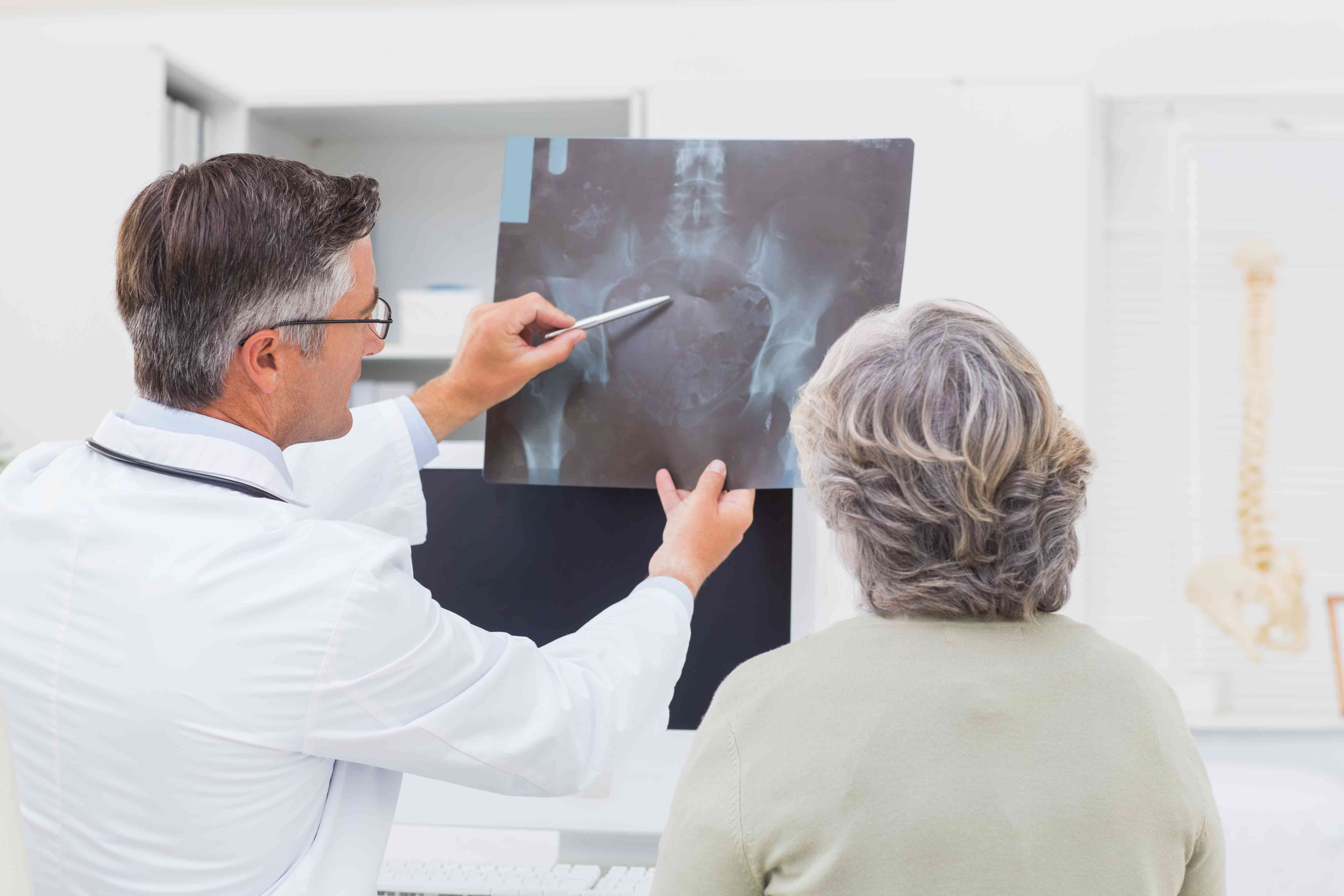 doctor-explaining-x-ray-female-patient-compressed